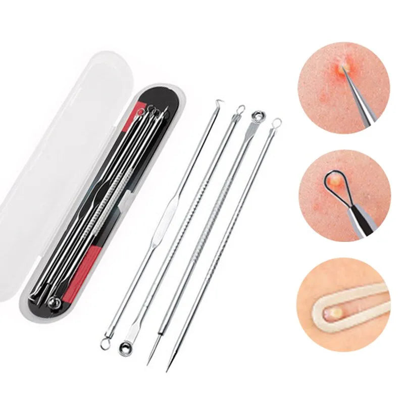 Kit de 4 ferramentas Extrator Acne Removedor de Cravos Aço inoxidável Espinhas - shopyordy